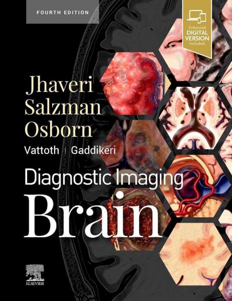 DIAGNOSTIC IMAGING BRAIN 2 Vol   2021 - رادیولوژی